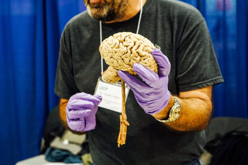 A man is shown wearing purple gloves holding a human brain. There is a blue backdrop behind him as he holds the brain in front of him.
